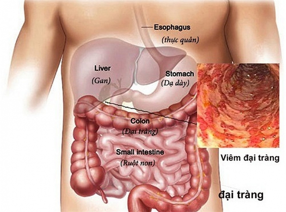 khi-nao-can-noi-soi-dai-trang-1