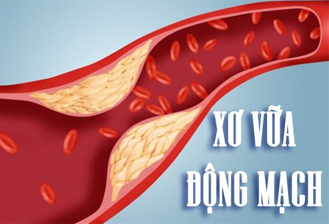 cholesterol-tang-cao-gay-anh-huong-cuc-xau-den-suc-khoe-2