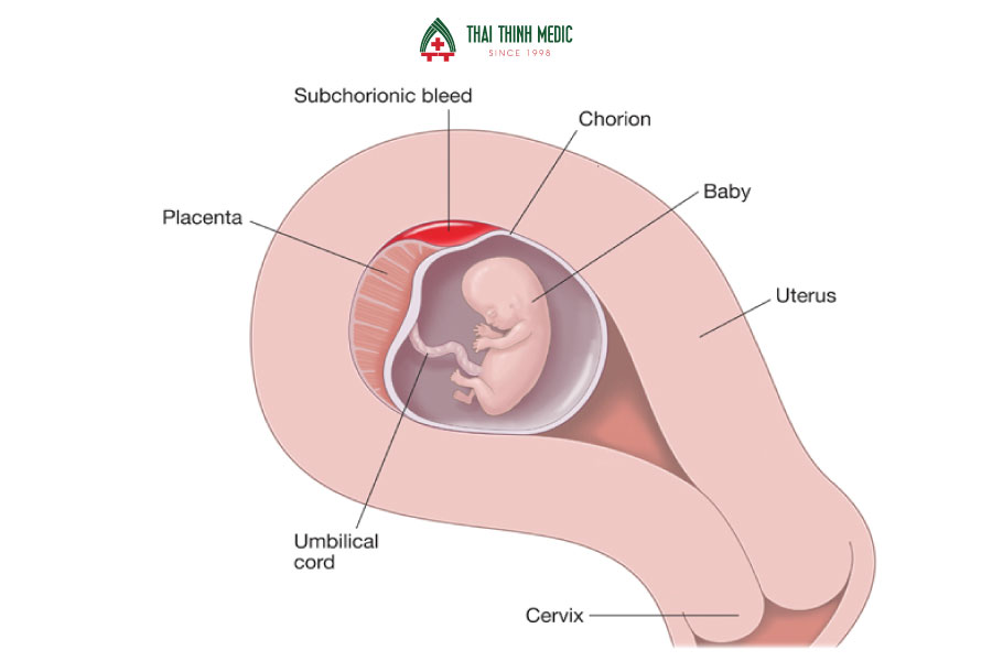 Tìm hiểu tụ dịch màng nuôi là gì và vai trò của chúng trong nông nghiệp